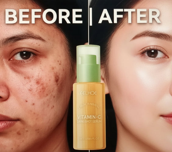 Vitamin C Brightening & Dark Spot Serum